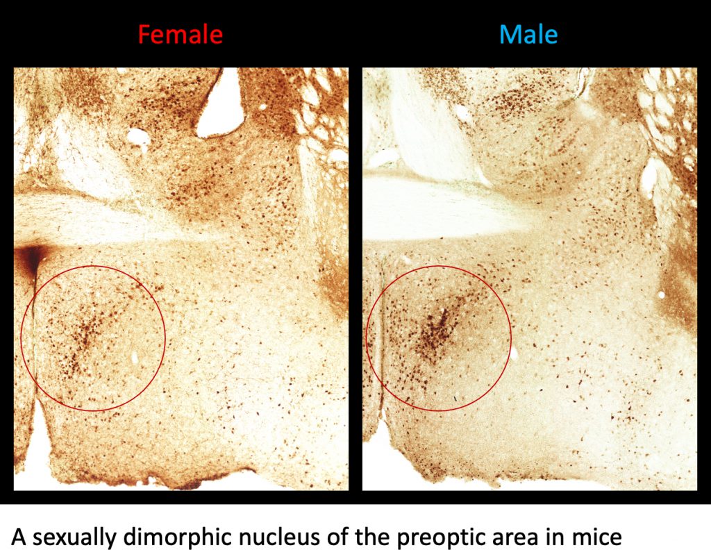 sexually dimorphic nuclei